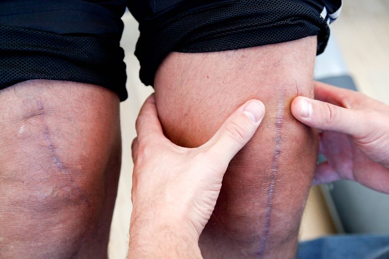 Knie erfahrungsberichte neues Schmerzen im